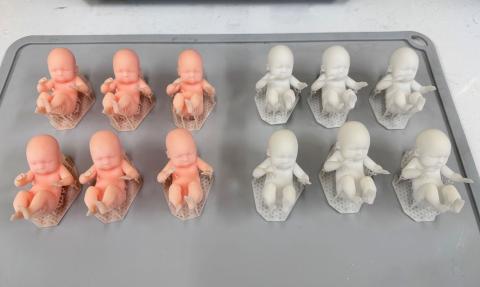 HRS fetal models made from 3D resin printers